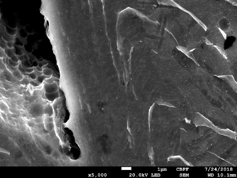 Micrographic detail of dimples inside a ductile crack.  HF+HNO3+H2O chemical etch.