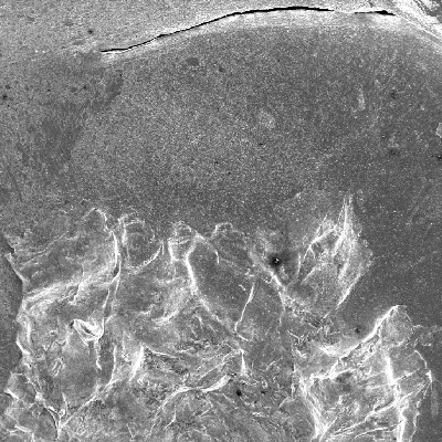Aspect of the surface of the plate by scanning electron microscopy, at the impact position, showing that the bullet was melted and deposited. The plate presented round cracks in the margin of the projectile impact position.