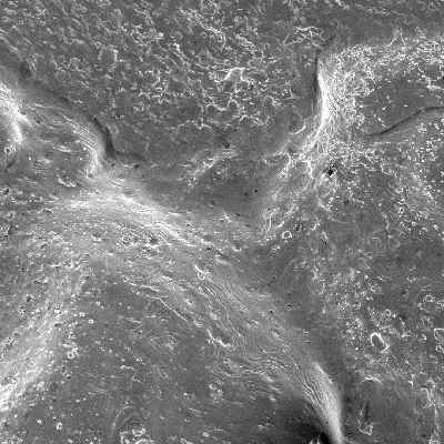 Aspect of the surface of the plate, by scanning electron microscopy, out of the center of the projectile impact position, showing that the melted bullet covered a large part of the surface.