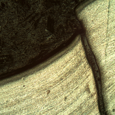 Micrography of the damaged plate at the side of the bullet impact, top of the figure. The projectile sheared the plate but did not perforate it, and the projectile materials (Cu and Pb) deposited at the .surface.   HF+HNO3+H2O chemical etch.