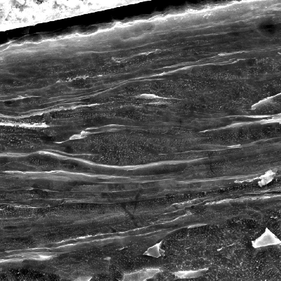 Micrographic detail by scanning electron microscopy of the plate section, close to the surface that suffered the impact. The projectile melted and created a film at the surface. The plate material presented a localized plastic deformation, aligning the grains. HF+HNO3+H2O chemical etch.