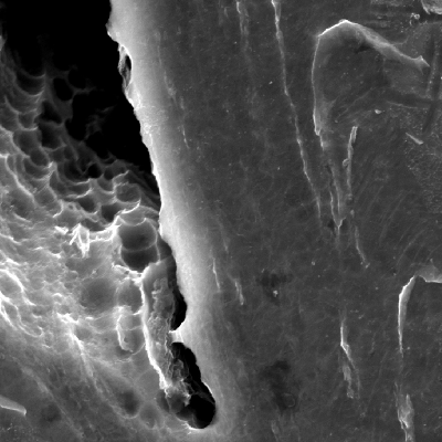 Micrographic detail of dimples inside a ductile crack.  HF+HNO3+H2O chemical etch.