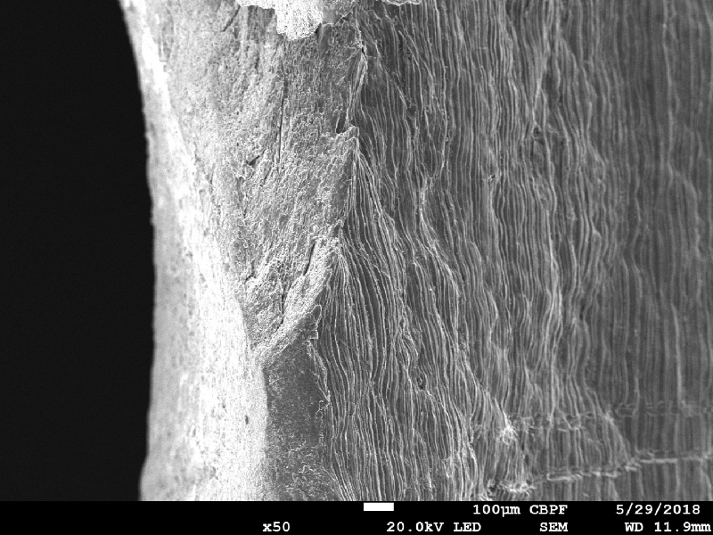 Margin of the perforated hole showing regions of fracture and a striated appearance at the plate surface (right side of the figure). This aspect is associated to the plate manufacturing.
