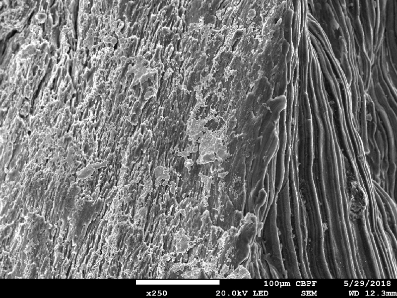 Margin of the perforated hole showing regions of melted material (from the bullet) in the hole (left side of the figure) and the striated surface of the plate (right side of the figure).