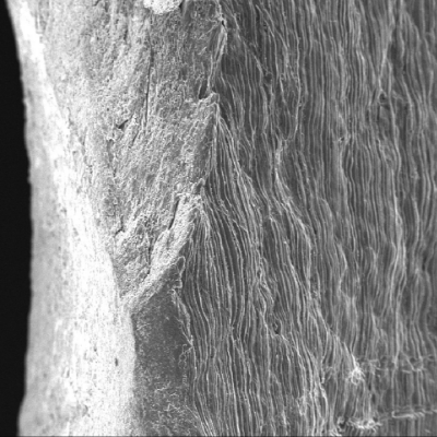 Margin of the perforated hole showing regions of fracture and a striated appearance at the plate surface (right side of the figure). This aspect is associated to the plate manufacturing.