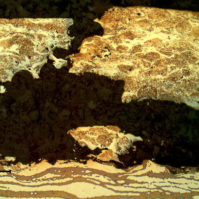 Micrographic detail of the damage surface layer, detached and broken.  The substrate is not affected and the rupture of the layer is typically by overloading.