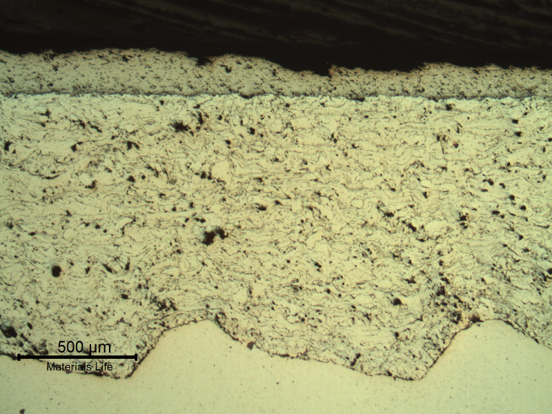 Micrography of a longitudinal section of the sleeve, in a region where the surface layer starts detachment. This grey layer is the tugnsten carbide; and the white layer (1000 microns) is a stainless steel. In this case the first TS layer is sound. The substrate is white in the bottom of the figure.