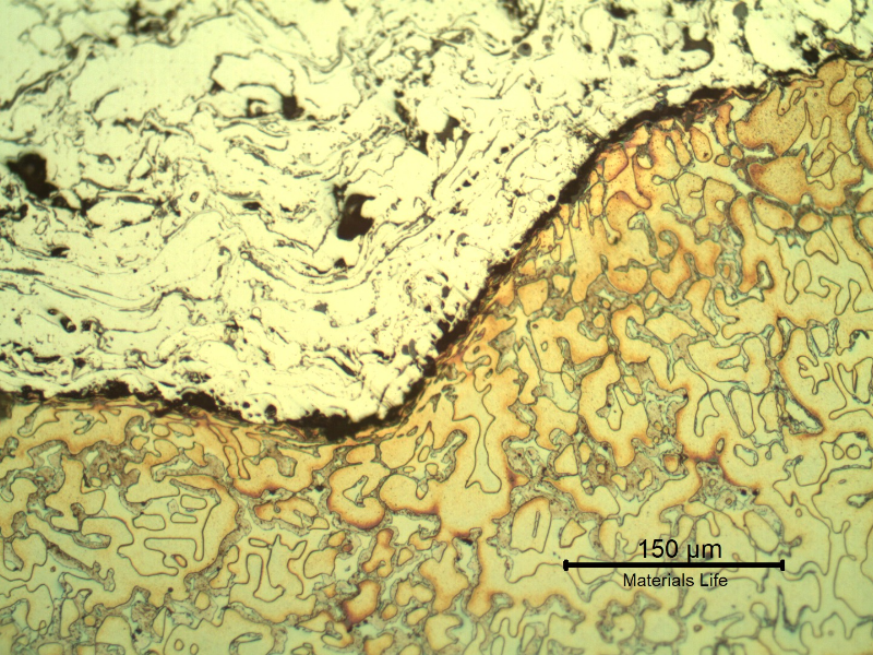 Micrography of the longitudinal section of the sleeve, at the interface between the substrate and the first thermal spray layer.  The substrate (bottom of the figure) shows a ferritic-austenitic microstructure and detrimental phases that look like sigma. The thermal spray layer (top of the figure) presents the non-etched stainless steel, disposed in layers, with oxides (gray) and voids (black).  The substrate is deformed in a thin layer at the interface.