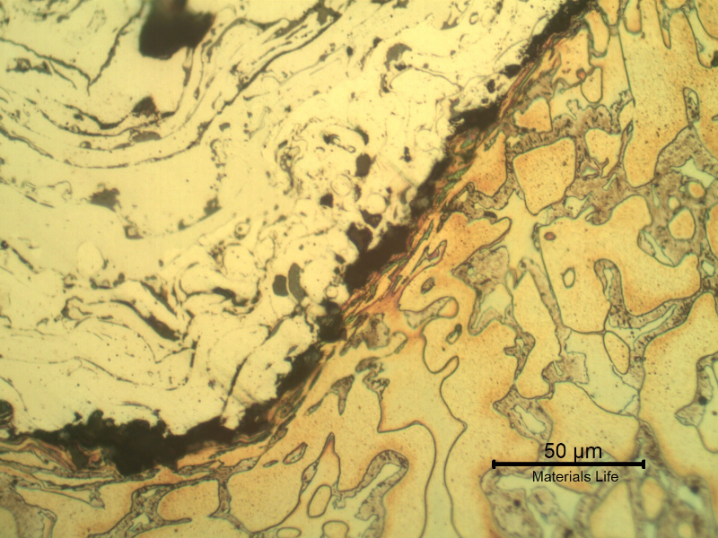 Micrographic detail of the interface between the substrate and the first thermal spray layer. The substrate (bottom of the figure) shows a ferritic-austenitic microstructure and detrimental phases that look like sigma at the delta and gamma interface. The thermal spray layer (top of the figure) presents the non-etched stainless steel, disposed in layers, with oxides (gray) and voids (black). The substrate is deformed in a thin layer at the interface.