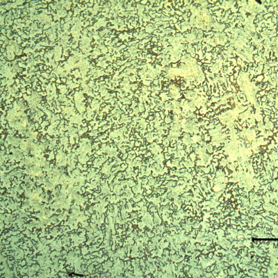 Micrography of the longitudinal section of the cast sleeve in the middle of the thickness. The microstructure is coarse, austenitic ferritic.