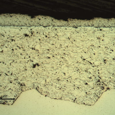 Micrography of a longitudinal section of the sleeve, in a region where the surface layer starts detachment.  This grey layer is the tugnsten carbide; and the white layer (1000 microns) is a stainless steel. In this case the first TS layer is sound.  The substrate is  white in the bottom of the figure.