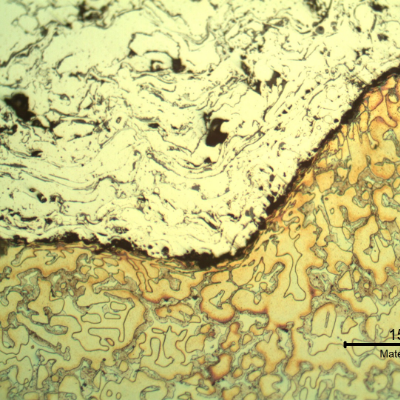Micrography of the longitudinal section of the sleeve, at the interface between the substrate and the first thermal spray layer.  The substrate (bottom of the figure) shows a ferritic-austenitic microstructure and detrimental phases that look like sigma. The thermal spray layer (top of the figure) presents the non-etched stainless steel, disposed in layers, with oxides (gray) and voids (black).  The substrate is deformed in a thin layer at the interface.