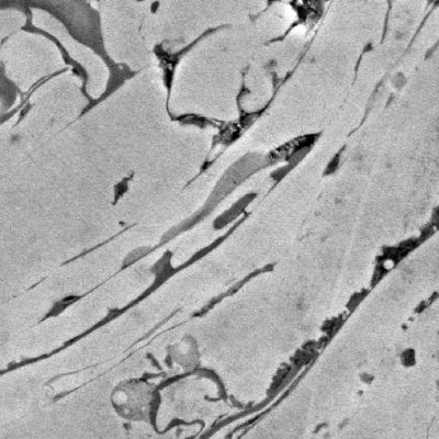 Micrographic detail of the first thermal spray layer, in stainless steel with the same composition of the base metal (lean duplex).