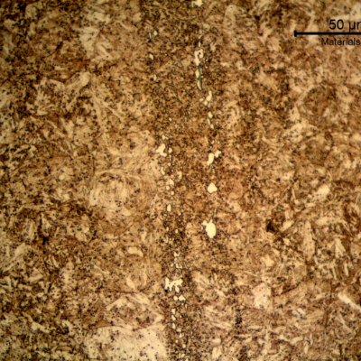 Micrographic detail of the nut longitudinal section presenting the large carbides (white islands) in the segregation band, and small precipitates all through the martensite matrix, indicating that this high carbon steel was tempered in a high temperature.  The 36HRc hardness also confirms this high tempering temperature.