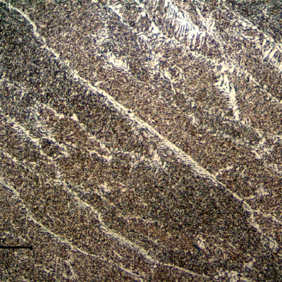 Micrography of the weld metal in the last bead, presenting previous austenite columnar grains, primary ferrite in the grain boundaries, some regions of ferrite with aligned second phases and acicular ferrite.