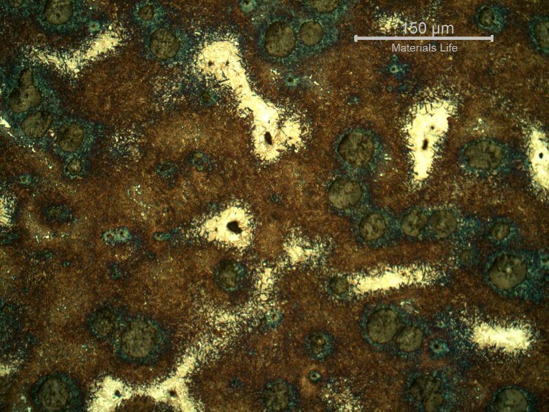 Micrography of the shaft very close to the surface, in a heat treated position.  Graphite in nodules. Dark blue martensitic microstructure around the nodules, brown yellow martensite and white islands of martensitic with retained austenite microstructure.