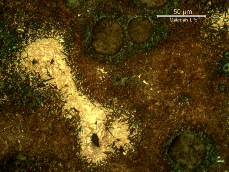 Micrographic detail of the graphite in nodules, dark blue martensitic microstructure around the nodules, brown yellow martensite and white yellow islands of martensitic with retained austenite microstructure.