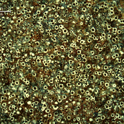 Micrography of the crankshaft in the center of the thickness.  The microstructure is nodules of graphite in a ferritic and pearlitic matrix, predominantly pearlitic.