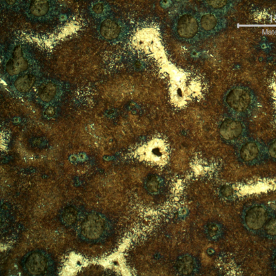 Micrography of the shaft very close to the surface, in a heat treated position. Graphite in nodules. Dark blue martensitic microstructure around the nodules, brown yellow martensite and white islands of martensitic with retained austenite microstructure.