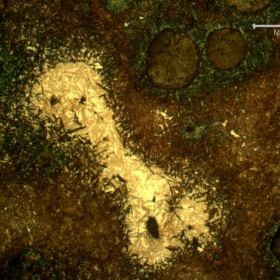 Micrographic detail of the graphite in nodules, dark blue martensitic microstructure around the nodules, brown yellow martensite and white yellow islands of martensitic with retained austenite microstructure.