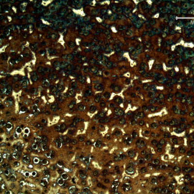 Micrography of the shaft below the heat treated surface, in the middle of the hardened layer.  There is a gradient in the colours.  Hardened surface in the top of the figure and nucleous in the bottom.