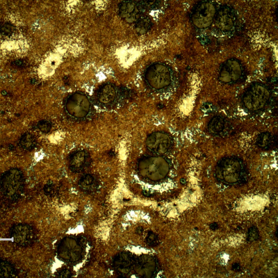 Micrography of the shaft below the heat treated surface. At this position, in the middle of the hardened layer , it is possible to see also white regions of ferrite, very close to the graphite nodules.