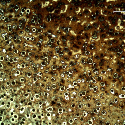 Micrography of the shaft below the heat treated surface, close to the limit of the hardened layer.  There is a gradient in the colours.  Hardened surface in the top of the figure and nucleous in the bottom.