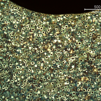 Micrography of the crankshaft at the surface, in the radio that is not heat treated.  The microstructure is nodules of graphite in a ferritic and pearlitic matrix, predominantly pearlitic.