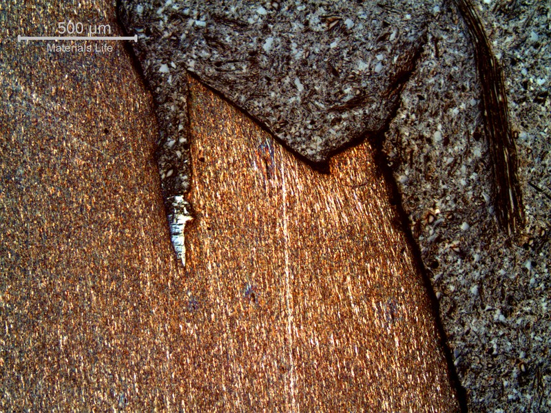 Micrography of a typical overloaded wire, in a longitudinal section, showing plastic deformation and necking at the fracture. About 25% of the wires have ruptured by this ductile mechanism.