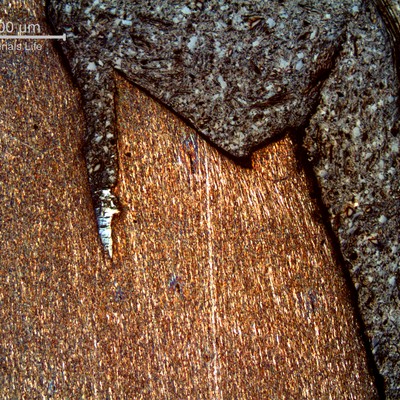 Micrography of a typical overloaded wire, in a longitudinal section, showing plastic deformation and necking at the fracture.  About 25% of the wires have ruptured by this ductile mechanism.