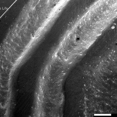 Aspect of the coaster surface grooves, by scanning electron microscopy in a low magnification,  showing in the right side the flat region that serves as a support; and in the left side the decorative grooves. The smooth surface in the groove suggests that the coasters were manufactured by casting.