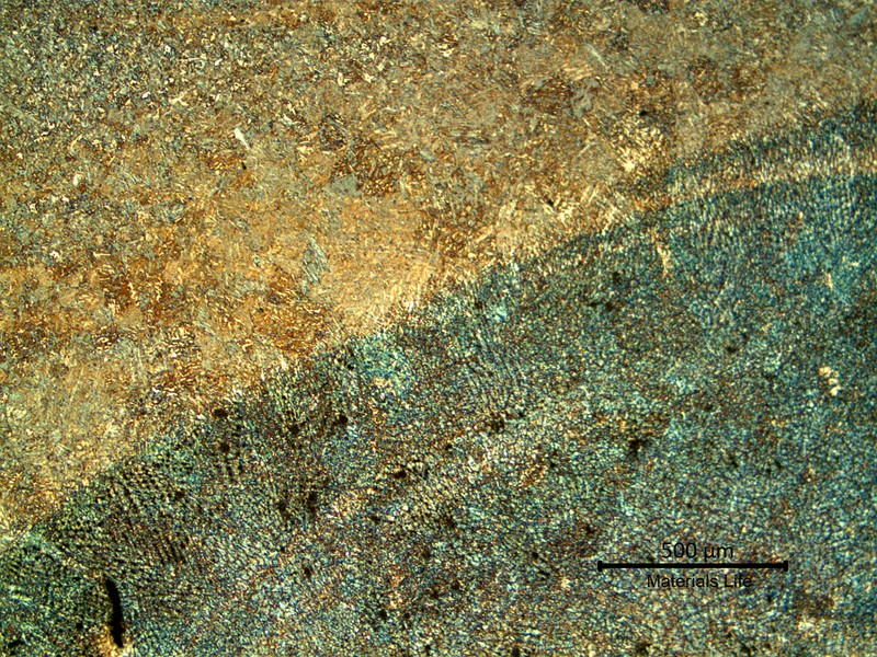 Low magnification micrography at the weld repair close to the internal surface of the valve body, in a longitudinal section.
Weld metal to the bottom and heat affected zone to the top.