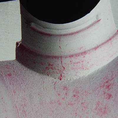 Penetrant test (dye check) image of the cracks at the surface of the actuator hole, viewed from inside of the body after the longitudinal cut.  The aspect of the cracks at the hole, close to the internal side of the valve, is not the same as the aspect of the cracks at the external side (a straigth line), suggesting that the original cracks had propagated by fatigue through wall. The penetrant did not stained too much at the cracked area, indicating that the cracks are not too deep in this position, or are not fully opened to the surface.