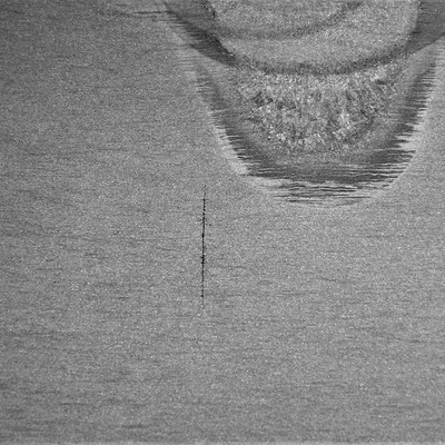 Macrographic detail of the longitudinal section of the valve body, at the cracked position, a little far from the actuator hole.  There is a straight crack, transverse to the thickness that clearly propagated by fatigue mechanism, from the region where the welding defects were created.