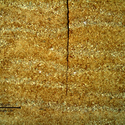 Micrography in low magnification of the straight crack in the valve thickness.  The crack propagates without following any microstructural aspect.  Fatigue is not influenced by microstructure, but by tensile stresses.