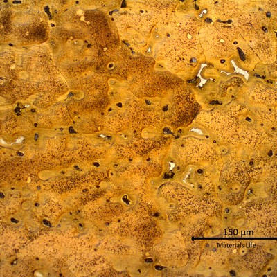 Micrography of a transverse section of the ring showing a cored alpha structure with segregation at interdendritic regions. This structure is in a region close to the ring surface.