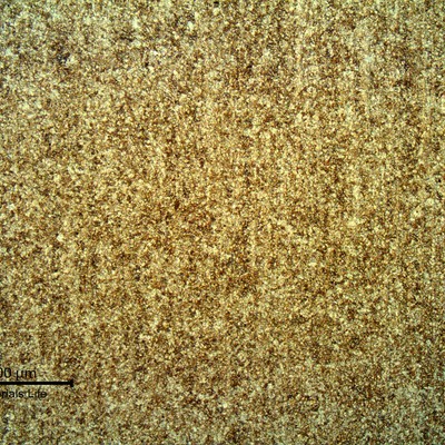 Micrography presenting a uniform and refined tempered martensitic structure.