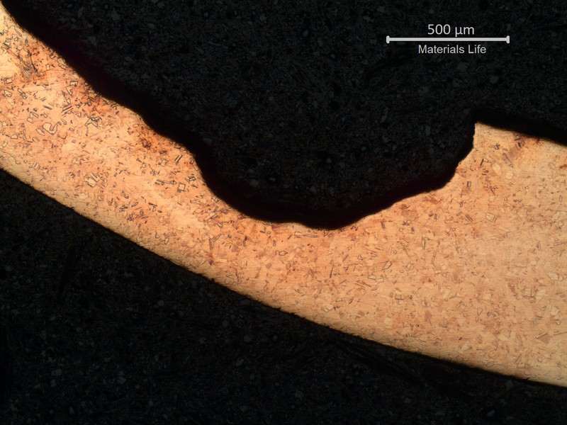 Micrography of a transverse section of the tube, close to the leakage point. The thickness is localized reduced where the internal passive layer was ruptured, and the chemical effect of the biological proliferation created a high corrosion rate.