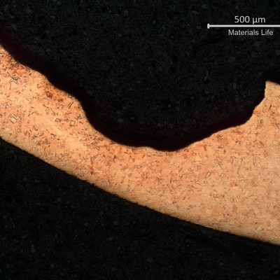 Micrography of a transverse section of the tube, close to the leakage point. The thickness is localized reduced where the internal passive layer was ruptured, and the chemical effect of the biological proliferation created a high corrosion rate.
