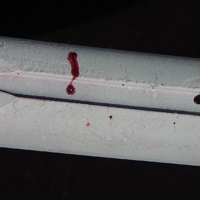 Dye check at the groove in the clamp ID, showing several parallel cracks, transverse to the clamp axis.