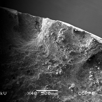 Fracture surface aspect at the scanning electron microscopy (SEM) of the clamp OD, showing different planes of propagation of the fracture.