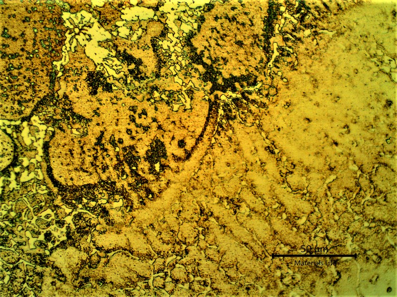 Fusion line between the aged base metal (in the top) and the weld metal (in the bottom). There is a region where the primary carbides melted (partially melted zone), that appears dark, and a region of high dilution cloe to the fusion line.