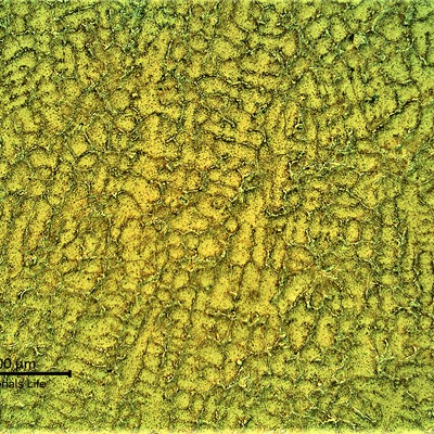 Cast fitting microstructure.  Network of primary carbides and austenitic matrix with coalescing secondary precipitation.
