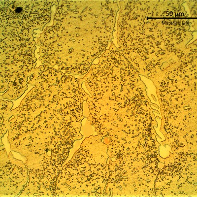 Micrographic detail of the network of primary carbided, white and grey, and an austenitic matrix with coalescing secondary precipitation.