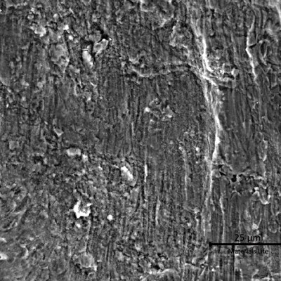 The propagation of the crack is also transgranular, without plastic deformation, by fatigue.