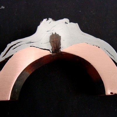 Transverse section of the tube in a position of wall perforation.