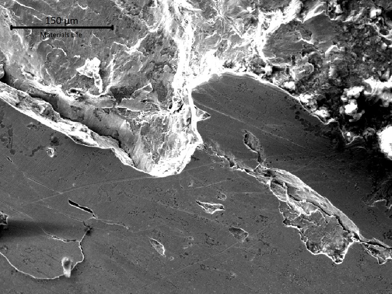 Aspect of the fractured tooth surface in a region presenting pitting, spalling and cracks.
