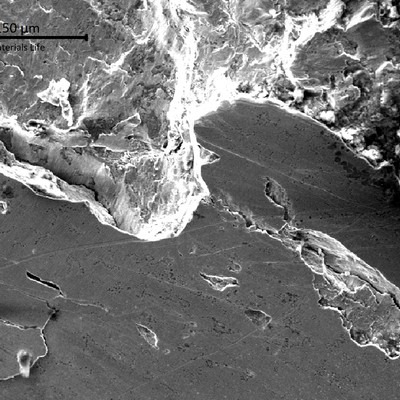 Aspect of the fractured tooth surface in a region presenting pitting, spalling and cracks.